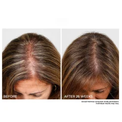 Cordless Hair Growth Comb