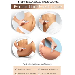 2-in-1 Cellulite Remover