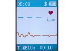 Portable Smart Bluetooth EKG Monitor
