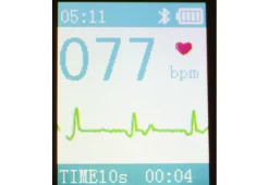 Portable Smart Bluetooth EKG Monitor