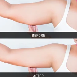 Underarm Toner