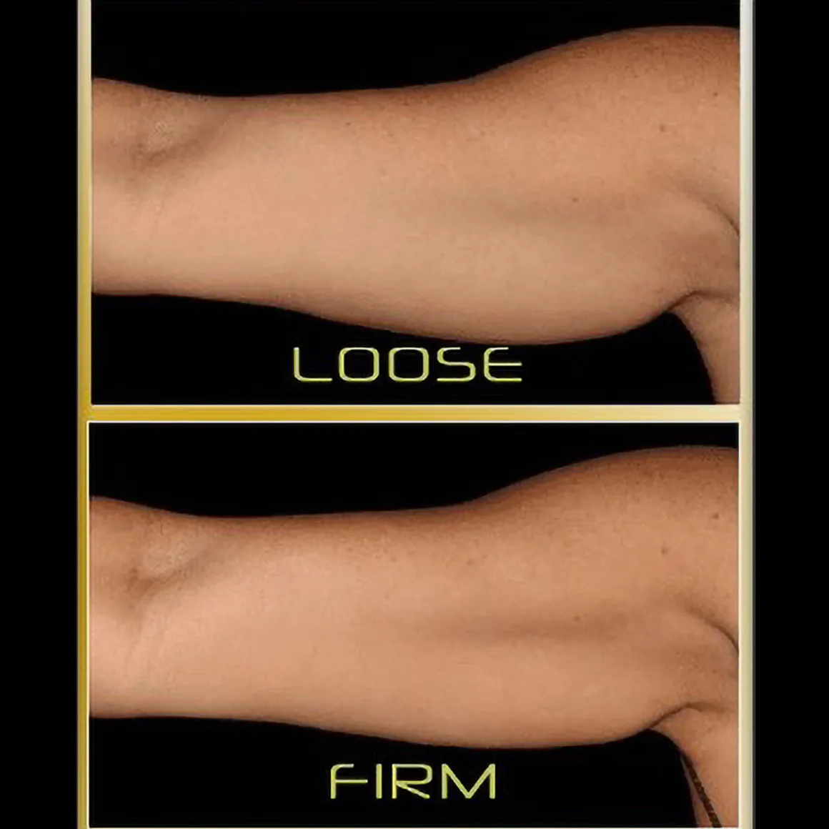 Underarm Toner