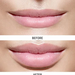 World's First At-Home Professional LED Lip Therapy Device